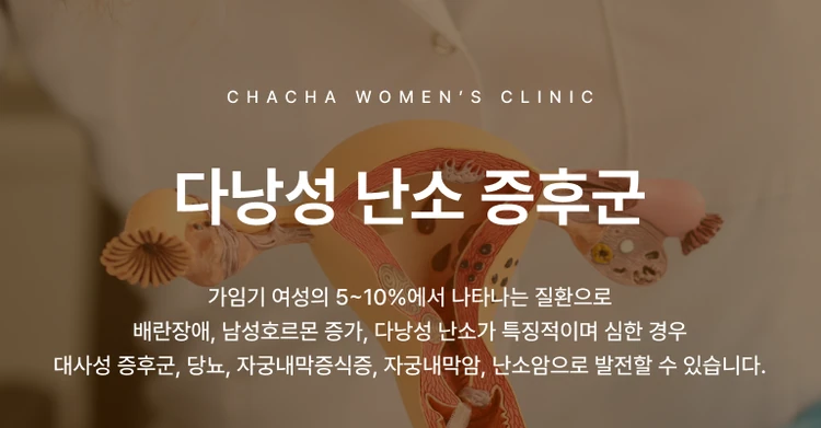 다낭성 난소 증후군