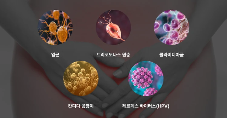 자궁경부염·자궁경부암