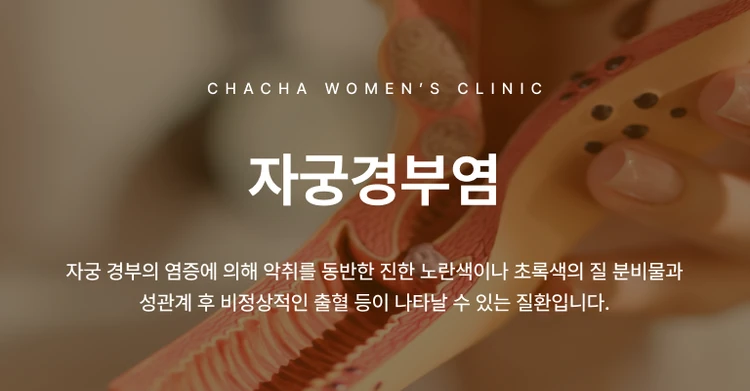자궁경부염·자궁경부암